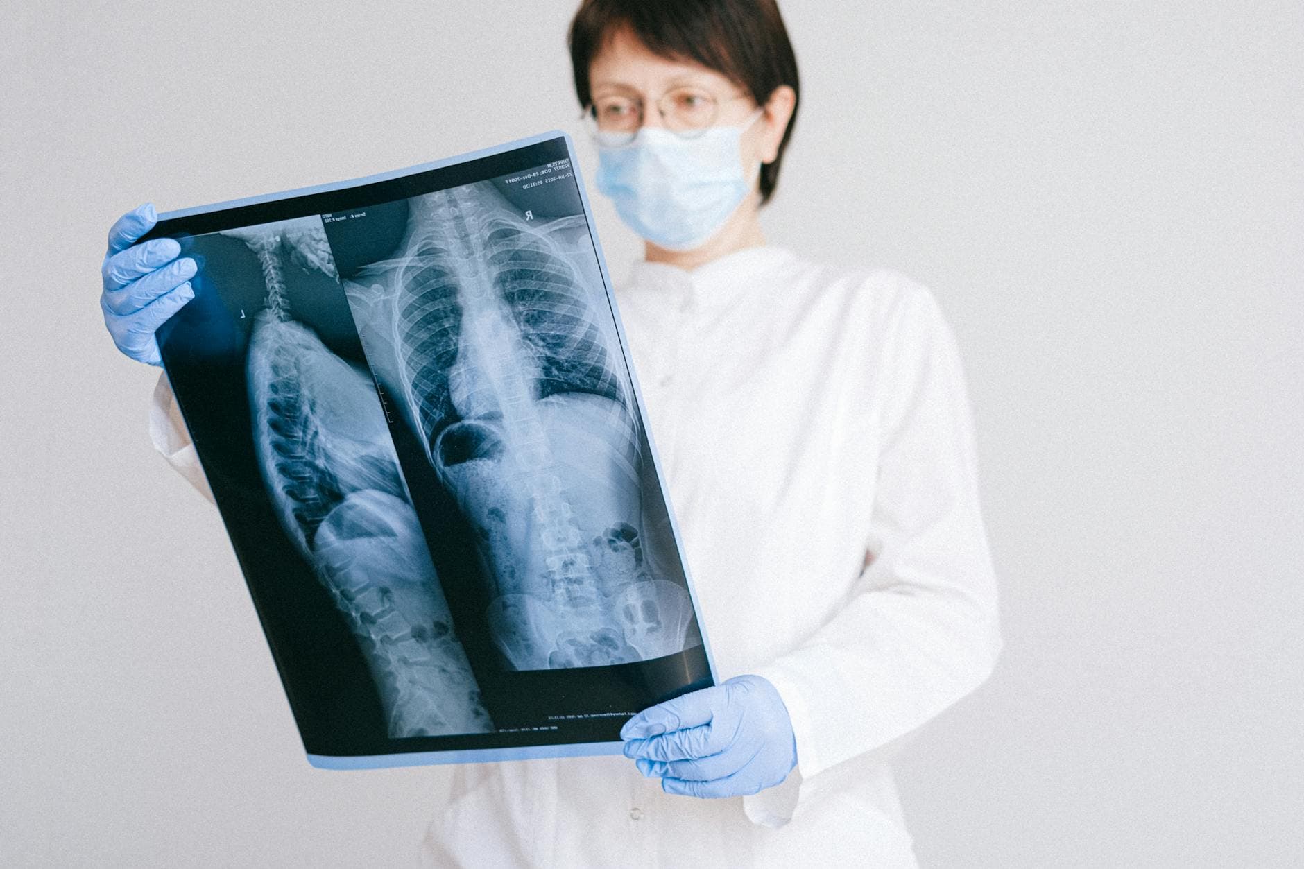 Doctor reviewing X-ray wearing protective gear in hospital setting.